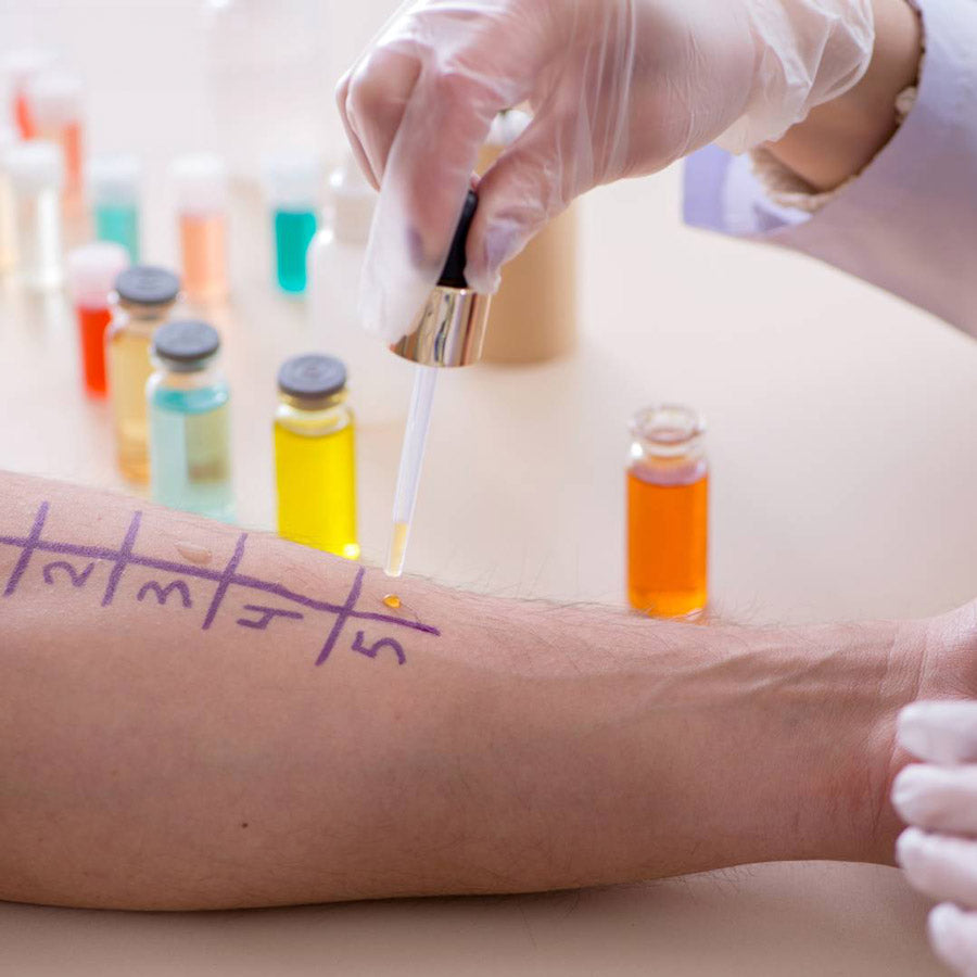 skin prick and patch testing